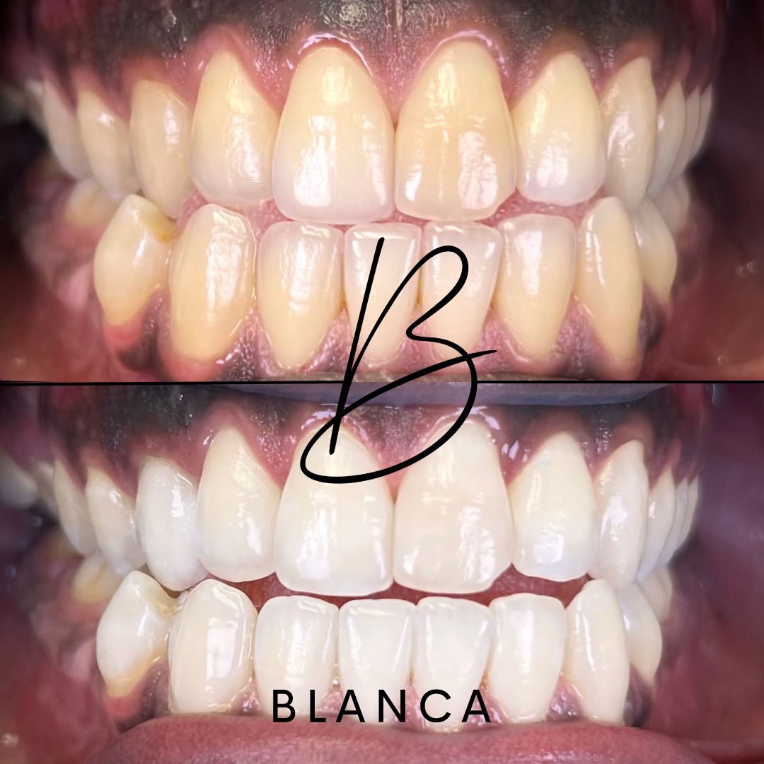 Blanca posts (4) 2.JPG__PID:4c131841-4b21-413b-95df-7de1324c4e60