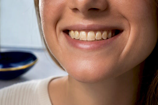 Close-up smile showing visible tooth surface staining