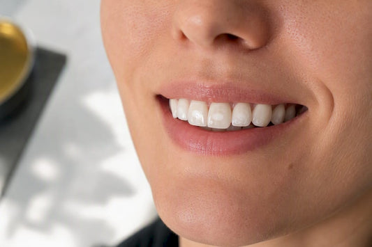 Smile showing subtle white spots after whitening