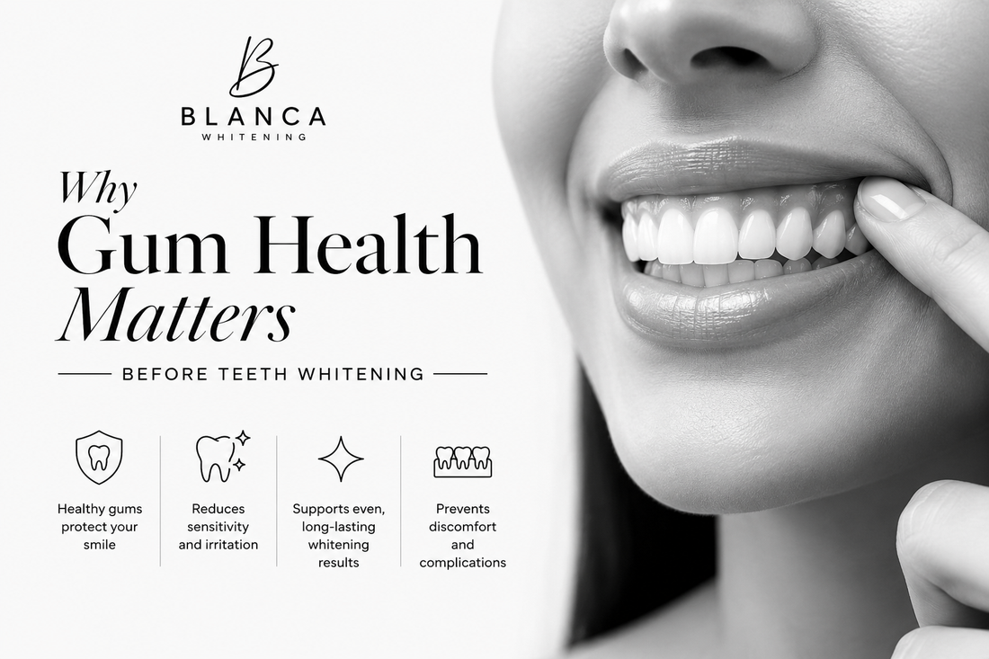Why Gum Health Matters Before Teeth Whitening